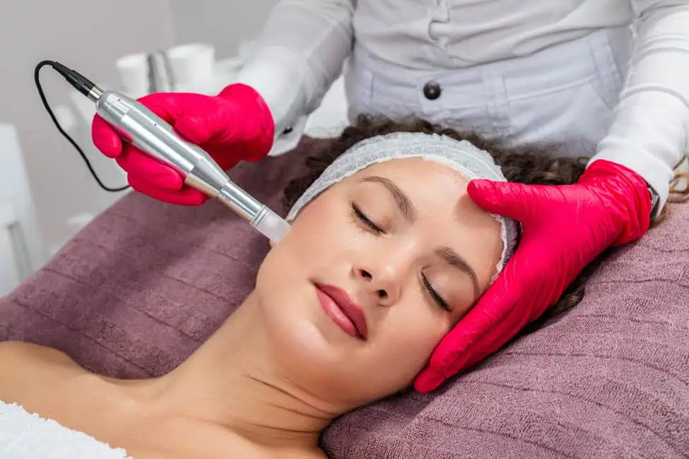 Microneedling by Lift Beauty & Wellness in moses lake, wa